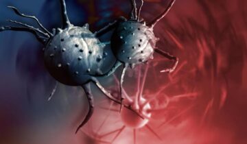 How Physical Stress Pushes Cancer Cells Into Dangerous New States