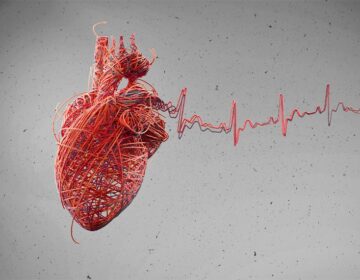 99% of heart attack, stroke, heart failure cases linked to preventable risk factors