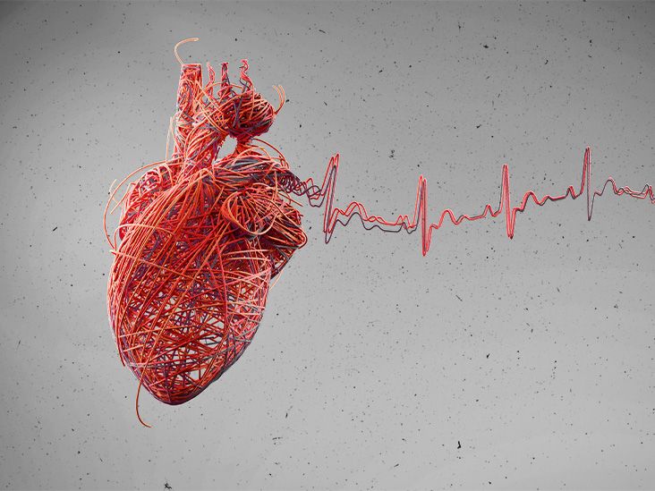 99% of heart attack, stroke, heart failure cases linked to preventable risk factors