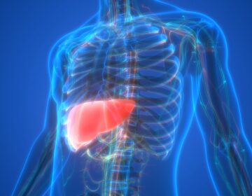 Existing Drugs Combine To Fight World’s Most Common Liver Disease
