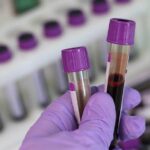 Blood Test Detects Head and Neck Cancer up to 10 Years Before Symptoms