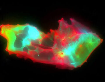 Scientists Uncover Hidden Blood Pattern in Long COVID