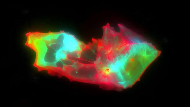 Scientists Uncover Hidden Blood Pattern in Long COVID