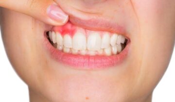 This Common Dental Problem Could Threaten Your Brain