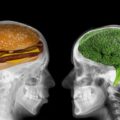 30,000 Brain Scans Reveal a Hidden Danger in Ultra-Processed Foods