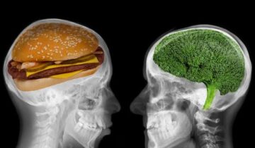 30,000 Brain Scans Reveal a Hidden Danger in Ultra-Processed Foods