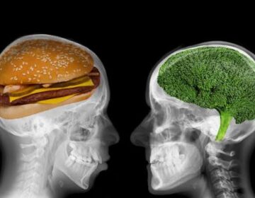 30,000 Brain Scans Reveal a Hidden Danger in Ultra-Processed Foods