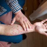 Your Skin Could Be Warning You About Mental Health Trouble