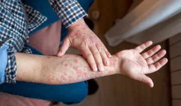 Your Skin Could Be Warning You About Mental Health Trouble