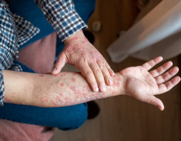 Your Skin Could Be Warning You About Mental Health Trouble