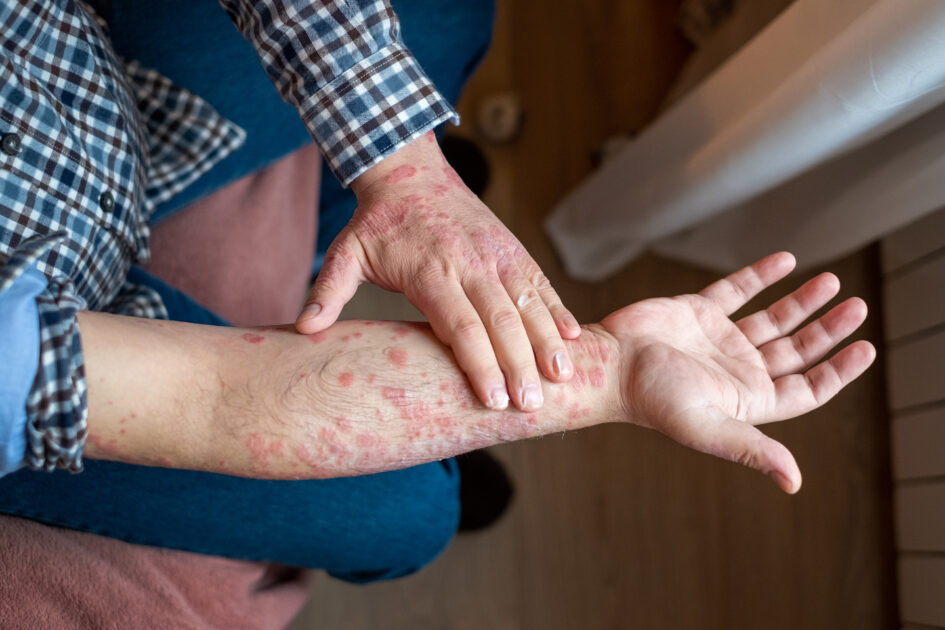 Your Skin Could Be Warning You About Mental Health Trouble