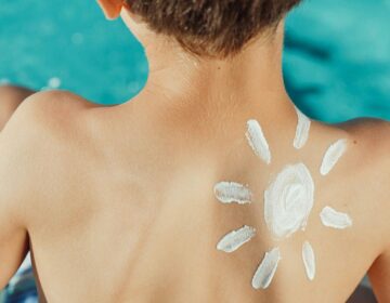 Scientists Discover How Sunburn Triggers a Hidden Cancer Chain Reaction