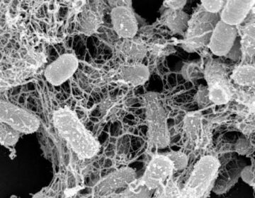 Scientists Discover Natural Protein That Traps and Kills Harmful Bacteria