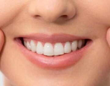 Whiter Teeth Without the Damage? This New Powder Could Change Oral Care