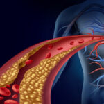 High cholesterol may predict future heart disease risk, even in healthy women