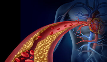 High cholesterol may predict future heart disease risk, even in healthy women