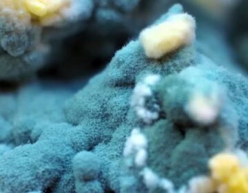 A Simple Blood Protein Could Transform Treatment of a Deadly Fungal Disease