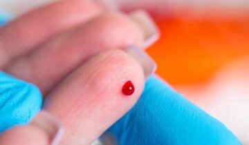 This New Blood Test Can Detect Cancer Before Tumors Appear