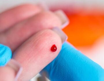 This New Blood Test Can Detect Cancer Before Tumors Appear