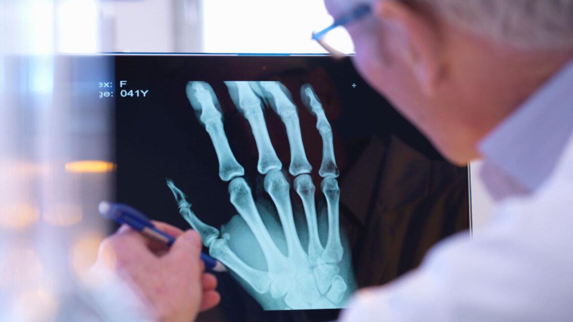 Even Doctors Can’t Tell These AI X-Rays Are Fake