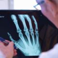 Even Doctors Can’t Tell These AI X-Rays Are Fake