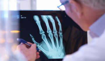 Even Doctors Can’t Tell These AI X-Rays Are Fake