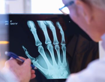 Even Doctors Can’t Tell These AI X-Rays Are Fake