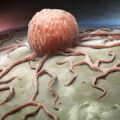 New Pancreatic Cancer Treatment Wipes Out Tumors and Blocks Drug Resistance