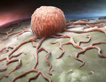 New Pancreatic Cancer Treatment Wipes Out Tumors and Blocks Drug Resistance