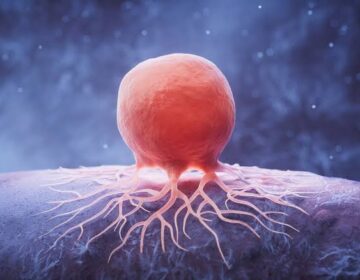 Scientists Uncover Hidden Weakness in Cancer Cells Tied to Vitamin B7