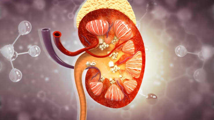 Why Drinking More Water Isn’t Enough To Stop Kidney Stones