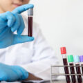 Simple and Cheap Blood Test Could Detect Cancer and Other Diseases Before Symptoms Appear
