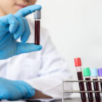 Simple and Cheap Blood Test Could Detect Cancer and Other Diseases Before Symptoms Appear