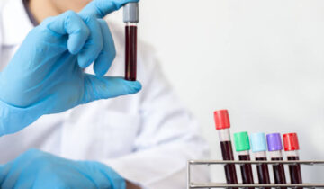 Simple and Cheap Blood Test Could Detect Cancer and Other Diseases Before Symptoms Appear