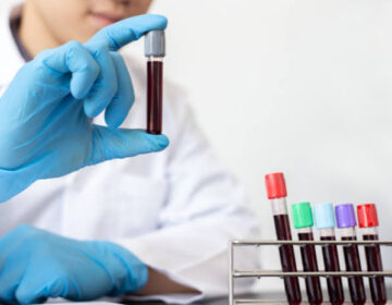 Simple and Cheap Blood Test Could Detect Cancer and Other Diseases Before Symptoms Appear