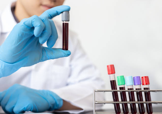 Simple and Cheap Blood Test Could Detect Cancer and Other Diseases Before Symptoms Appear