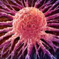 Scientists Turn Cancer’s Own Bacteria Against It in Breakthrough Therapy