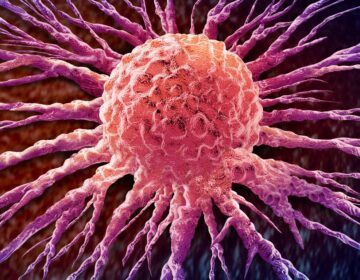Scientists Turn Cancer’s Own Bacteria Against It in Breakthrough Therapy