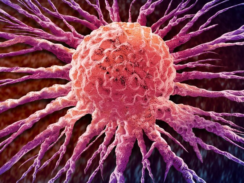 Scientists Turn Cancer’s Own Bacteria Against It in Breakthrough Therapy