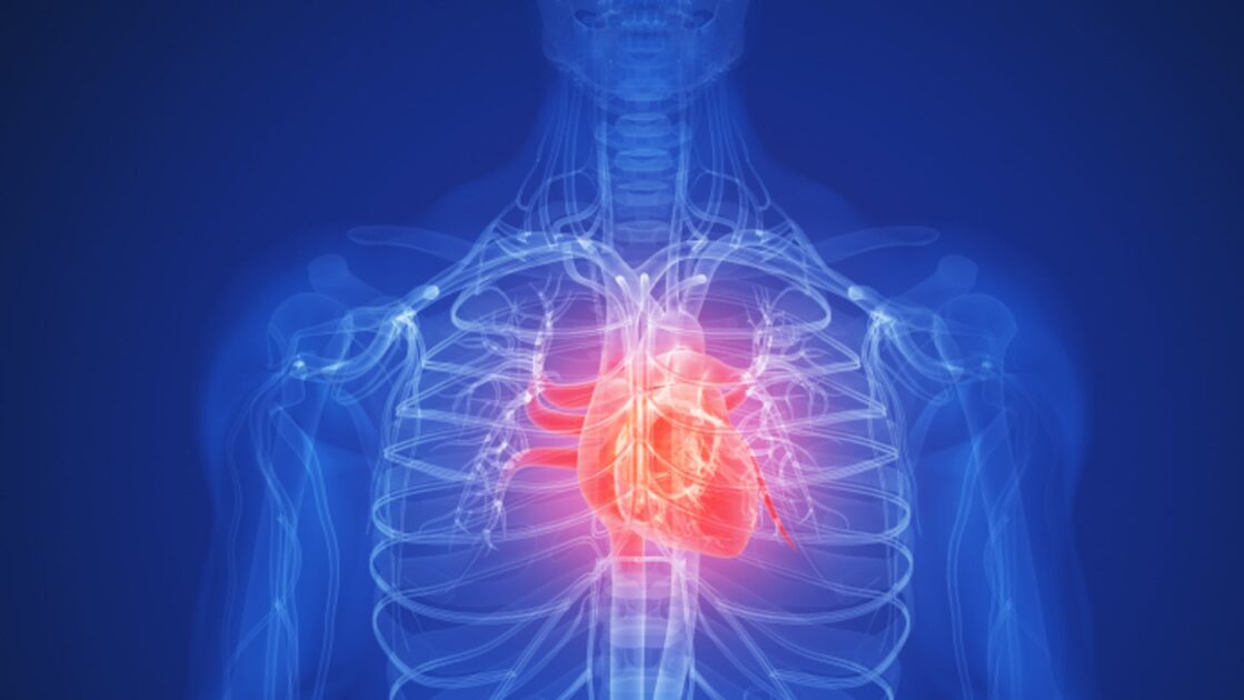 Hidden Heart Risk Found in 1 in 5 People, Study Warns