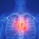 Hidden Heart Risk Found in 1 in 5 People, Study Warns