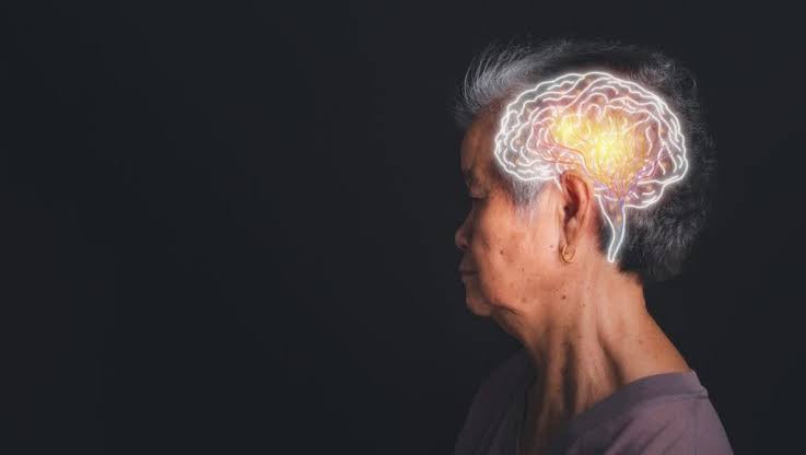 Alzheimer’s May Begin Decades Earlier Than You Think, New Mayo Clinic Study Finds