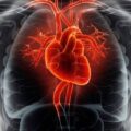 Popular Weight-Loss Drugs Found To Cut Heart Attack and Stroke Risk