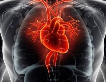 Popular Weight-Loss Drugs Found To Cut Heart Attack and Stroke Risk