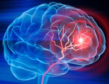 Scientists Reverse Stroke Damage Using Stem Cells in Breakthrough Study