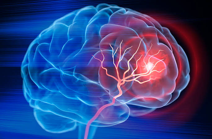 Scientists Reverse Stroke Damage Using Stem Cells in Breakthrough Study