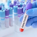 A Normal Kidney Test Could Still Signal Serious Risk