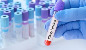 A Normal Kidney Test Could Still Signal Serious Risk