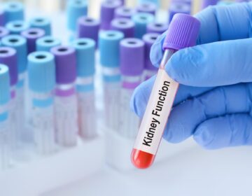 A Normal Kidney Test Could Still Signal Serious Risk