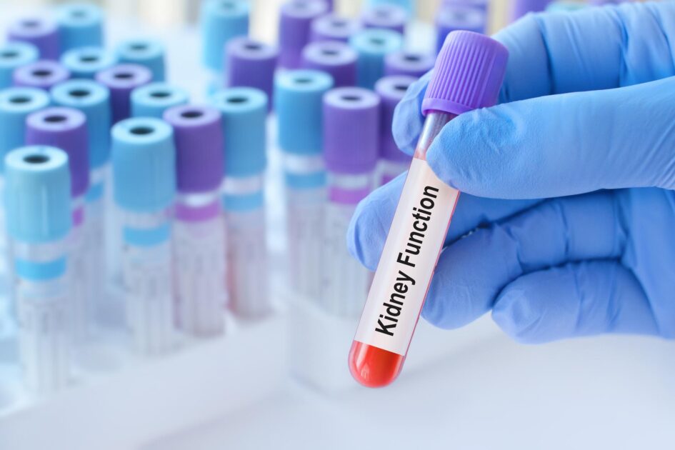 A Normal Kidney Test Could Still Signal Serious Risk